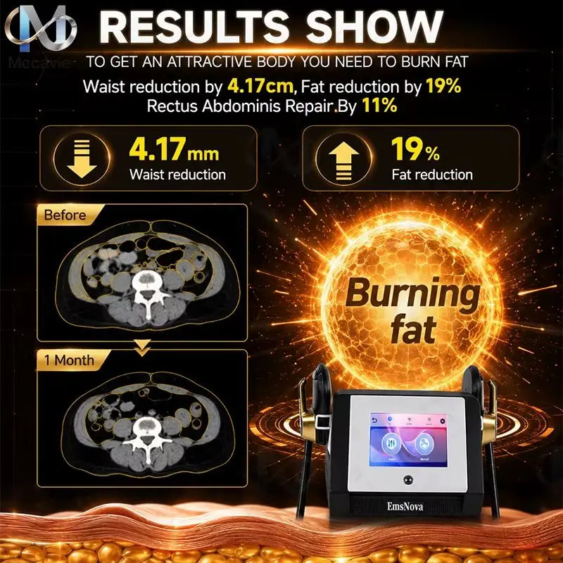 2026 New Salon Grade Ems 6500W EMSnova RF Body Shaper Muscle Toning and Weight Loss Professional Fat Burning DeviceRemoval
